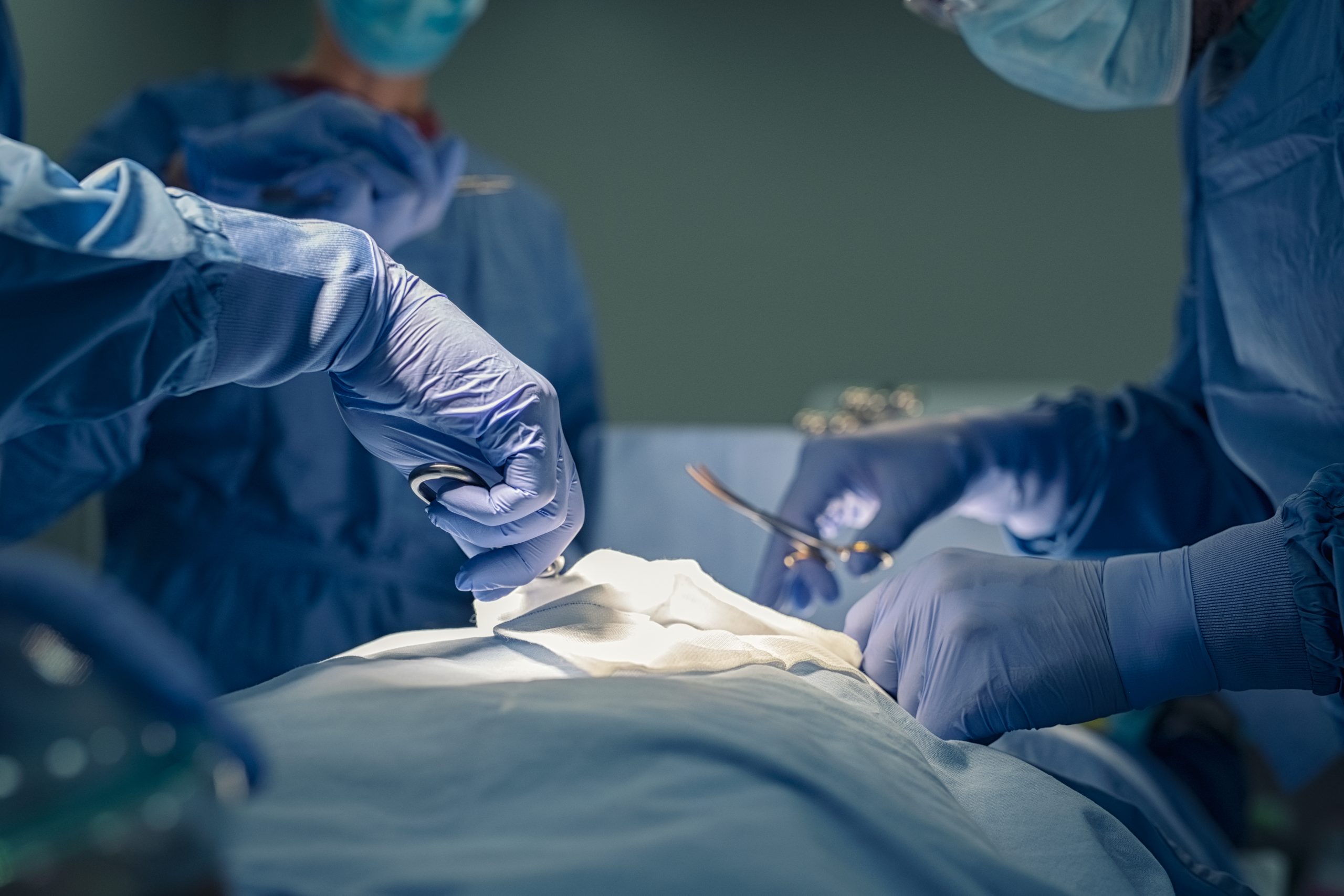 Close up of surgeons performing surgery Close up of hands of medical team performing surgery at operation theater. Group of surgeons at work in operating theatre saving patient life. Detail of group of doctors hands and healthcare workers holding medical instruments and working in operating room.
